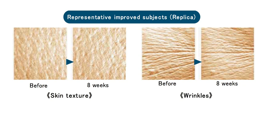 ProSkin Set (Elastin Complex + Hialuron Complex) 2 x 60 capsules - Image 9